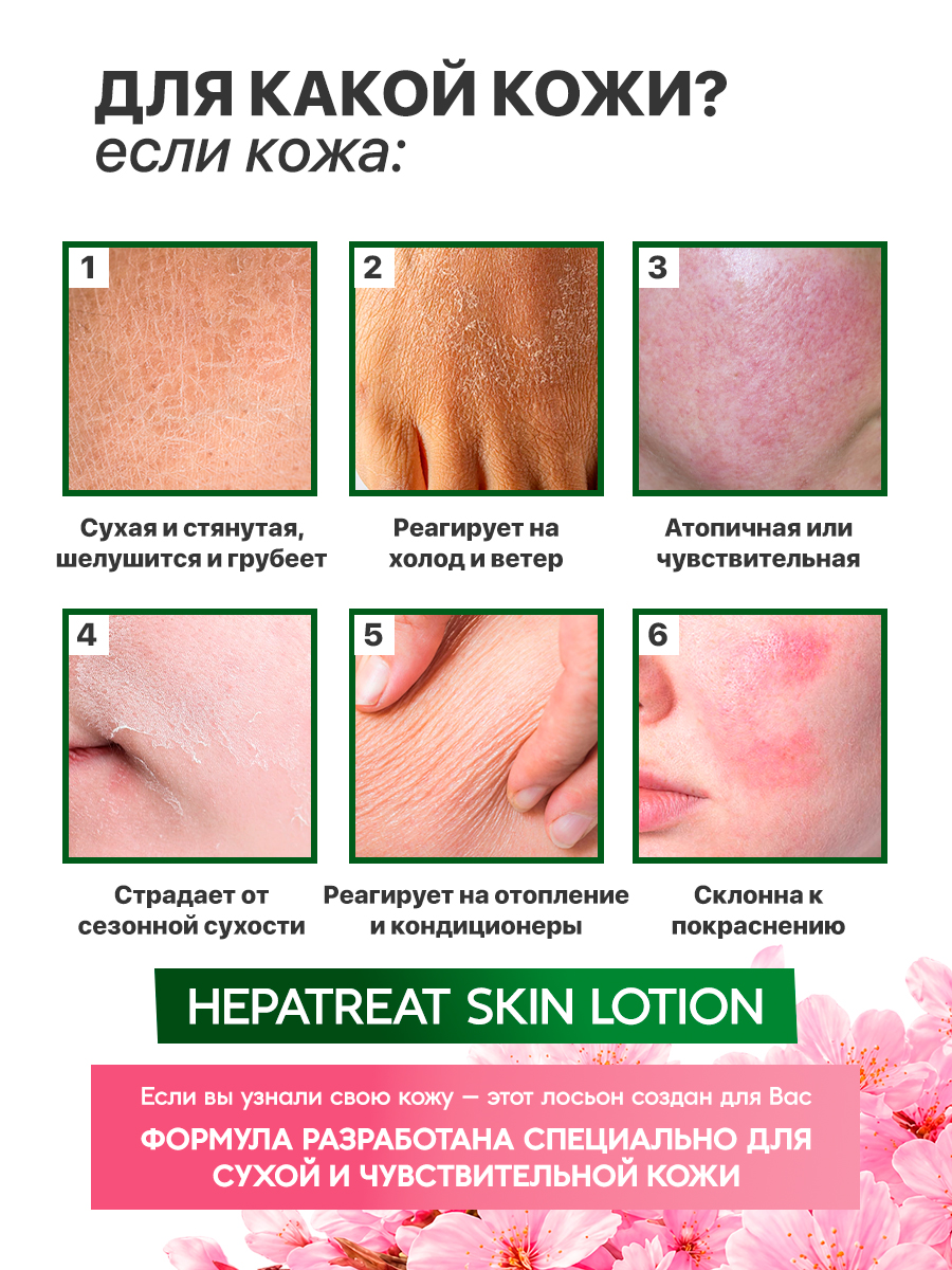 Hepatreat Skin Lotion — косметический лосьон для кожи, ТМ ZETTOC.  Для лица и тела для чувствительной кожи, 380 мл