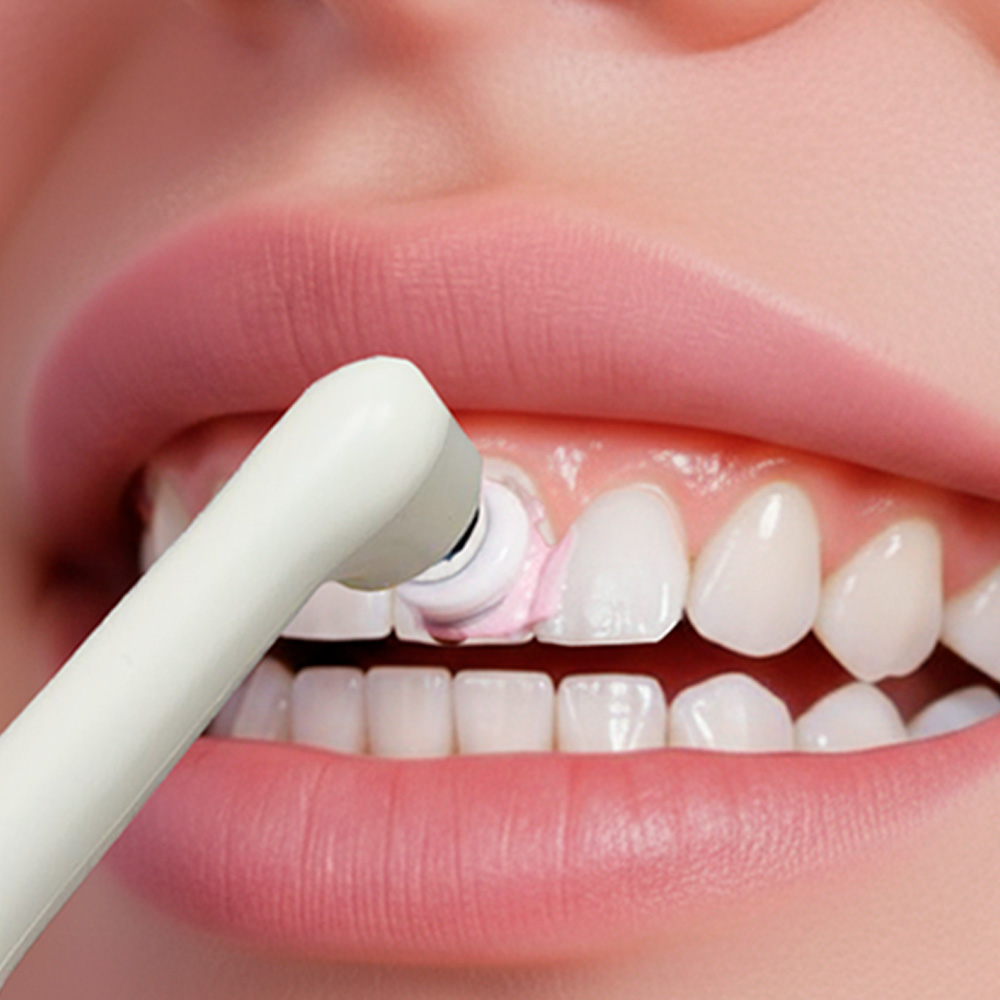 Комплект сменных насадок и проф. пасты для электрического аппарата /электрической щетки для полировки зубов / полишера, ТМ «DentalTouch» DT-P100-W / DT-P100-BL