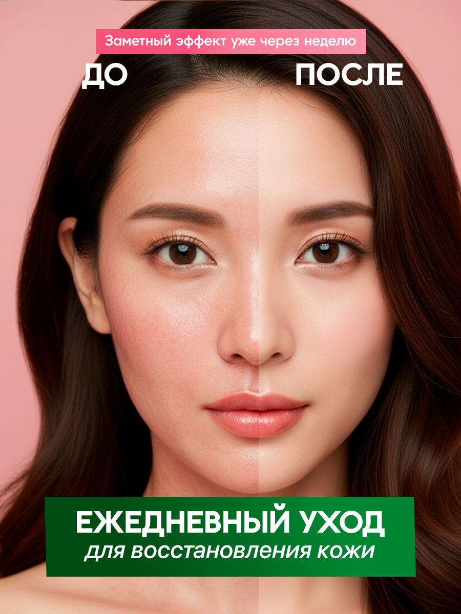 Hepatreat All in One Gel — гель для кожи ТМ ZETTOC. Для лица и тела для чувствительной кожи,  230 г