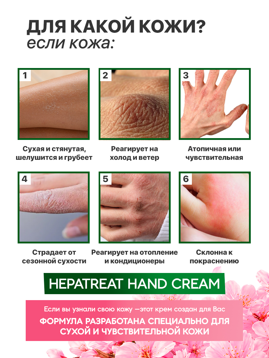Hepatreat Hand Cream — крем для кожи,  ТМ ZETTOC. Для рук, 60 г