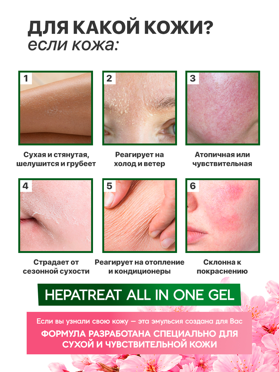 Hepatreat All in One Gel — гель для кожи ТМ ZETTOC. Для лица и тела для чувствительной кожи,  230 г